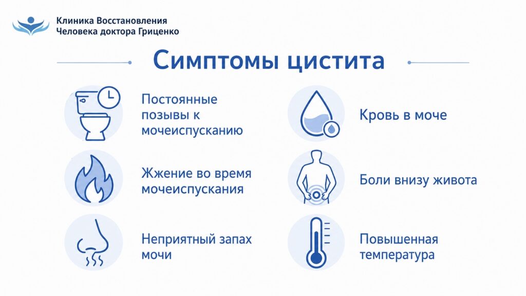 Симптомы цистита