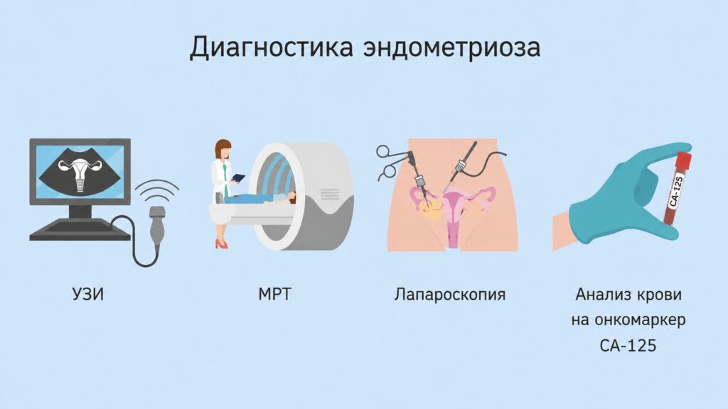 Диагностика эндометриоза